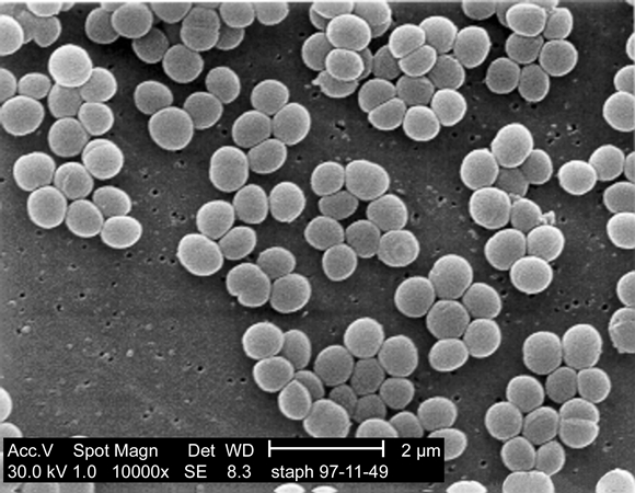 Staphylococcus_aureus_01.jpg