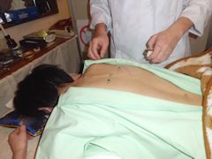 施術中の写真3